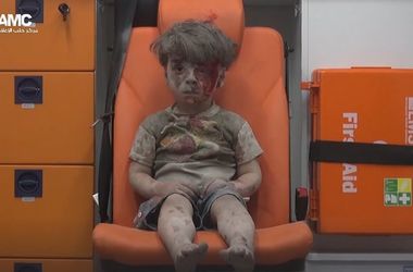Умер брат мальчика, чье фото стало символом жертв войны в Сирии