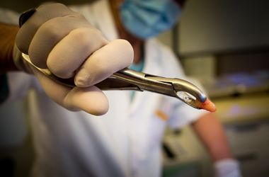 В России стоматолог сломал челюсть пациентке